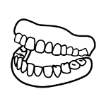 Dental implant