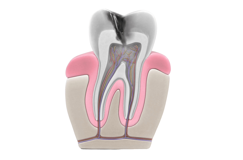 ROOT CANAL TREATMENT