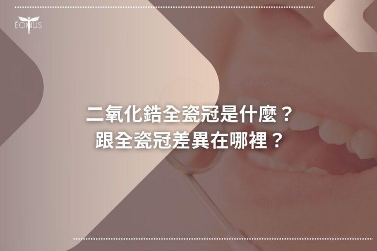 root canal treatment price63653