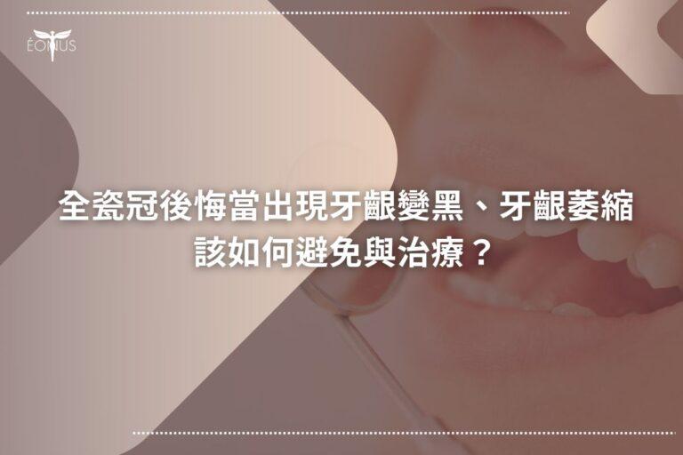 root canal treatment cost750