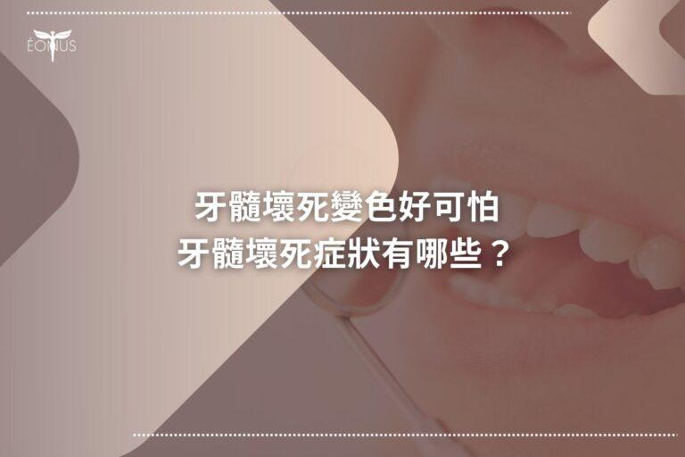 root canal treatment cost767
