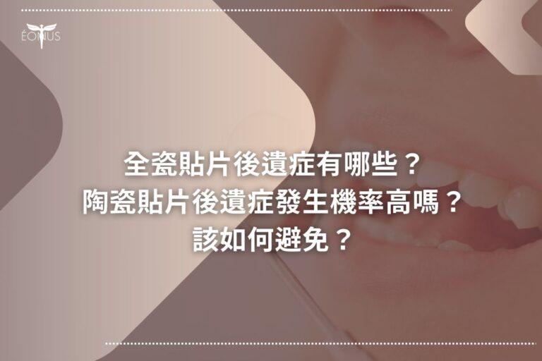 全瓷貼片後遺症有哪些?陶瓷貼片後遺症發生機率高嗎?該如何避免? 1 root canal treatment price65463