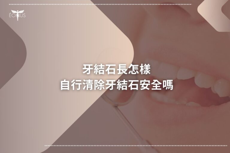 root canal treatment price345