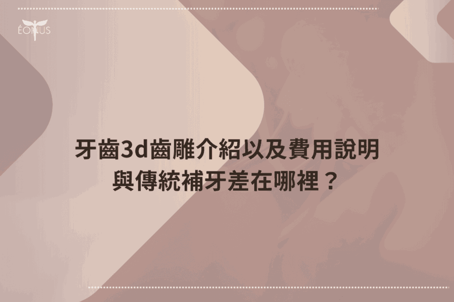 根管治療價錢